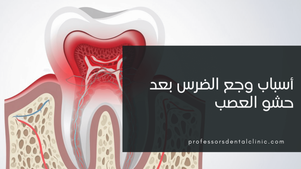 سبب وجع الضرس بعد حشو العصب – الأسباب والحلول الفعالة